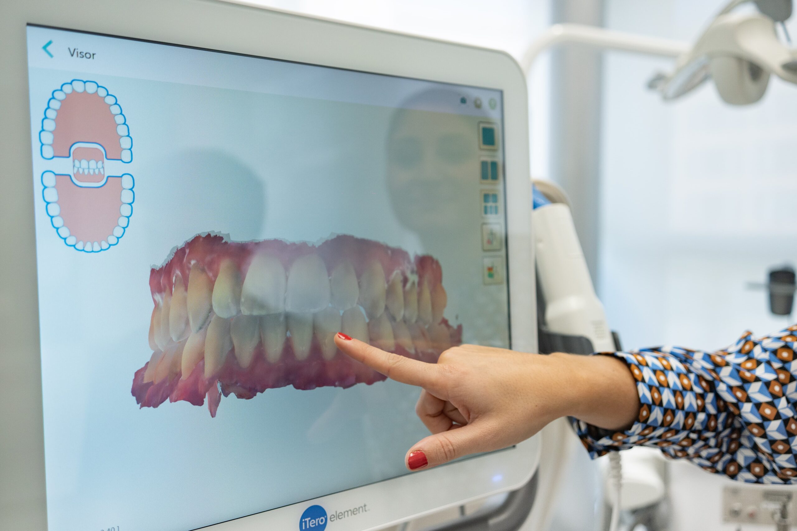 maloclusión dental